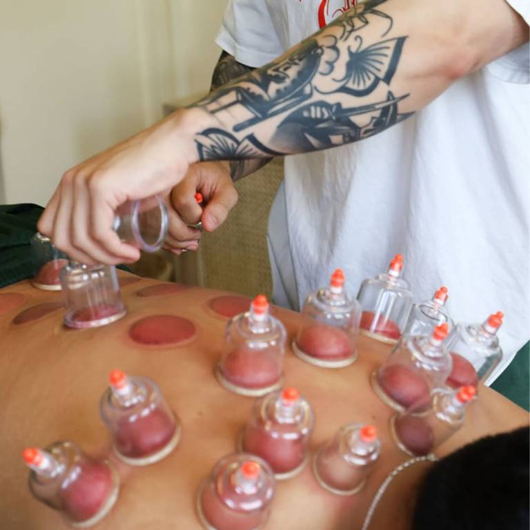 Feel Good Acupuncture & Wellness