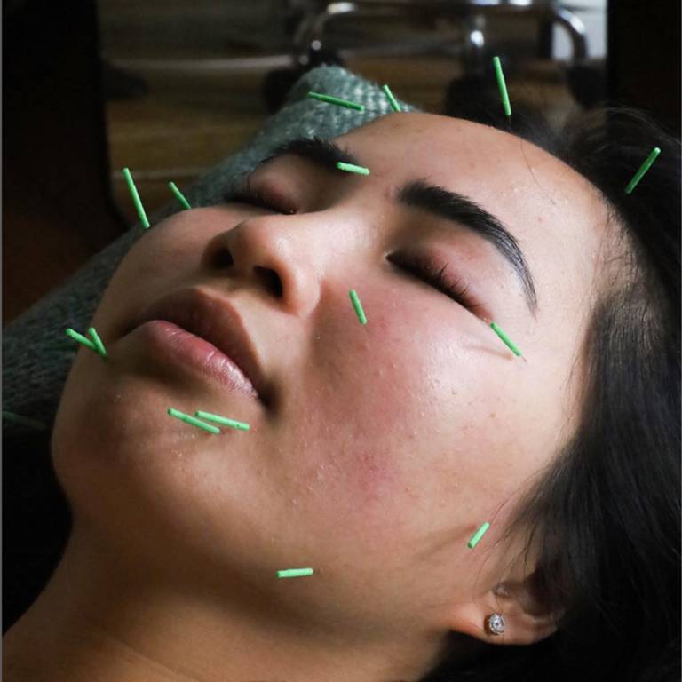 Feel Good Acupuncture & Wellness