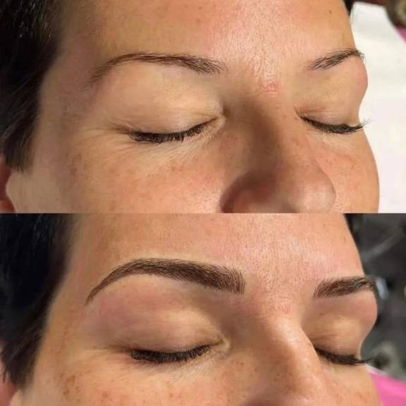 Brow