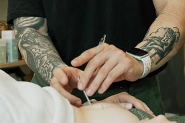 Feel Good Acupuncture &amp; Wellness