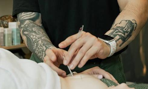 Feel Good Acupuncture & Wellness